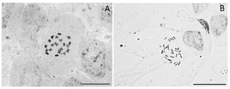 Zwei Mikroskopaufnahmen von Cannabis-Metaphaseplatten: 20 Chromosomen beim Diploiden (A) und 30 beim Triploiden (B).